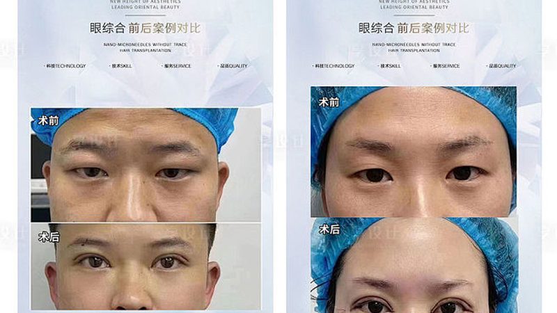 生活美容VS医疗美容：揭秘两者本质差异