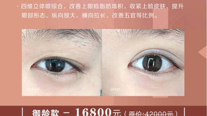热玛吉面部流程：揭秘美丽背后的科学步骤