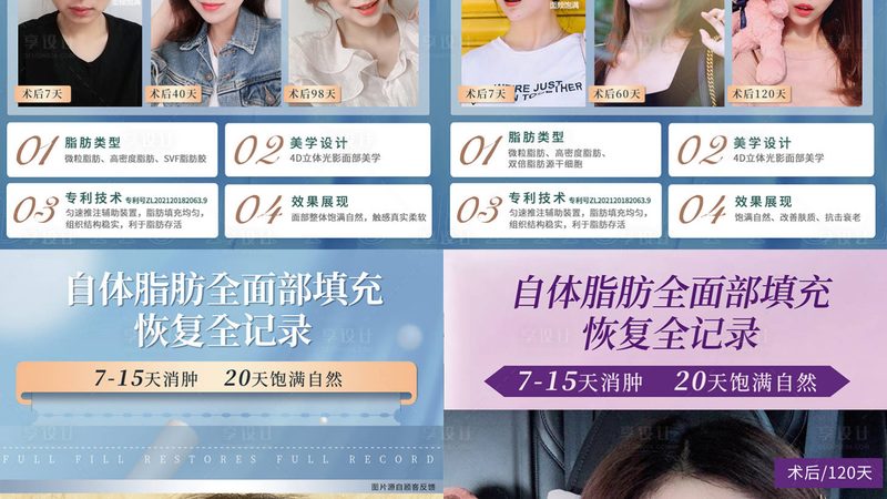 在佩戴近视镜时，应注意以下几点：