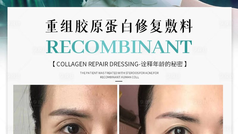 射频与激光：面部提升技术的双重选择