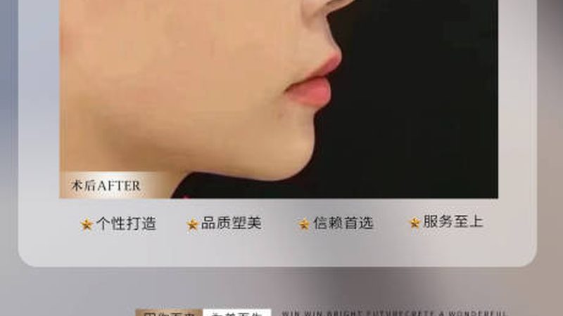 瘦脸绷带，你真的会用吗？揭秘正确使用方法**