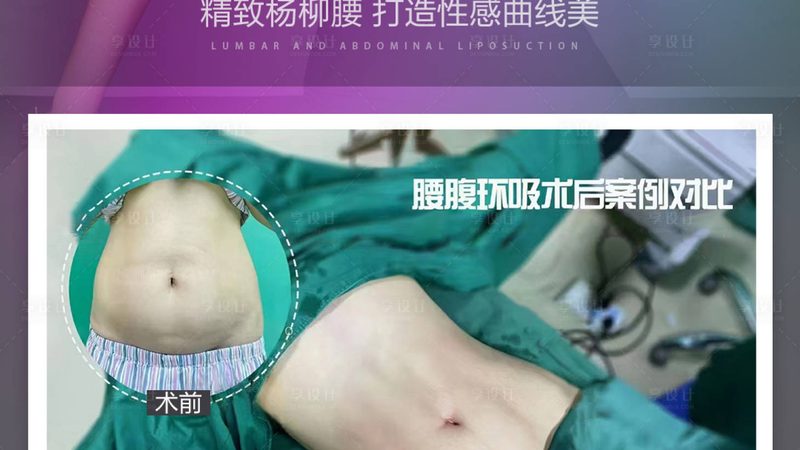 热玛吉VS线雕：揭秘两种抗衰老技术的本质区别