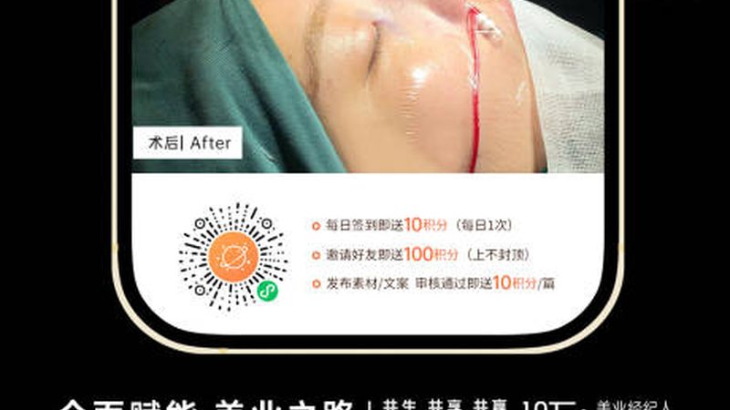 敏感肌适用家用光子嫩肤仪吗？揭秘家用光子嫩肤仪的真相