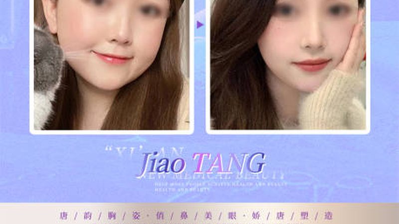 强脉冲光与光子嫩肤：揭秘仪器型号分类背后的秘密