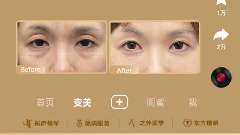 早上瘦脸按摩，这样按，轻松打造小脸美人
