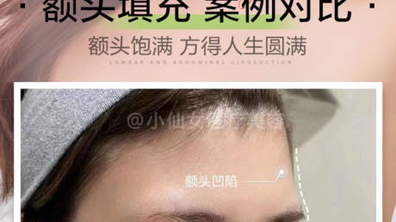 水光针代加工厂家的对比